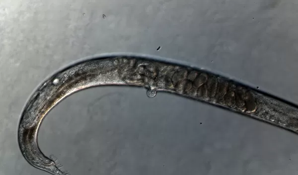 Photo of an intersex C. elegans worm carrying eggs.
