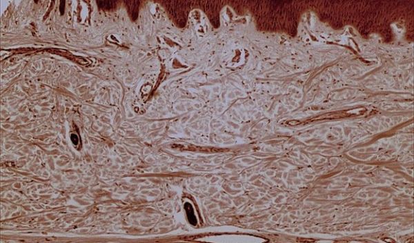 human sweat glands