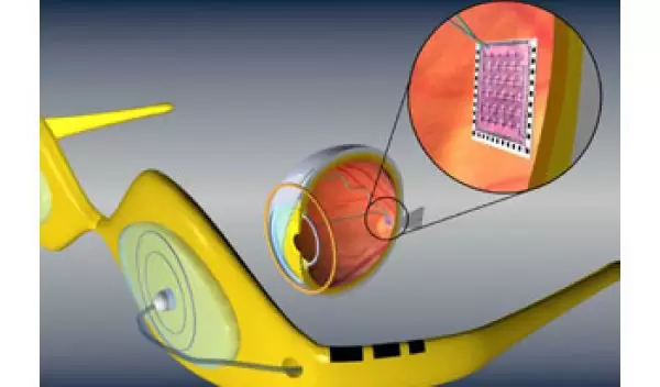 Artificial retina device