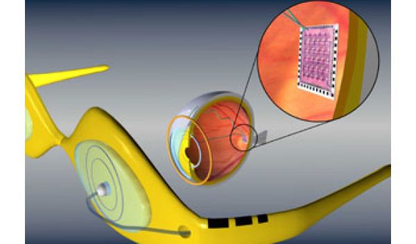 Artificial retina device