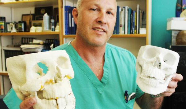 Photo of surgeon Jon Wagner holding plastic casts of fractured jaws.