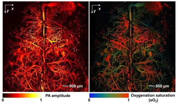 mouse brain imaged using photoacoustic microscopy.