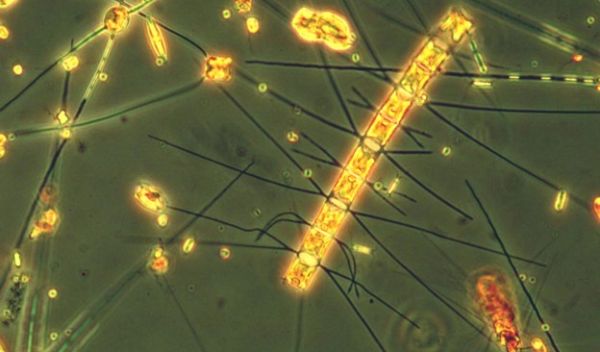 Large-cell diatom algae Chaetoceros