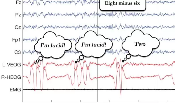 a recording of electrical signals from a sleeping participant's mind and eyes