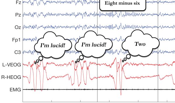 a recording of electrical signals from a sleeping participant's mind and eyes