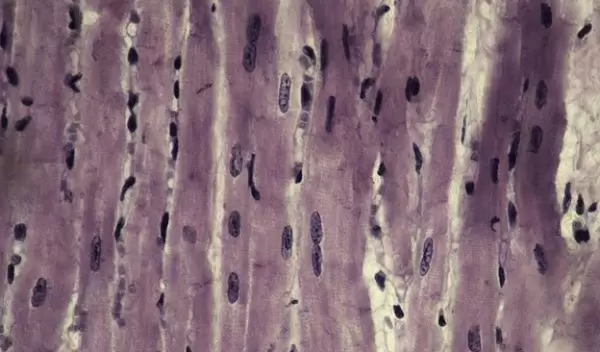 Interdisciplinary teams replicated how mechanical forces reorganize the nuclei of organic tissue.