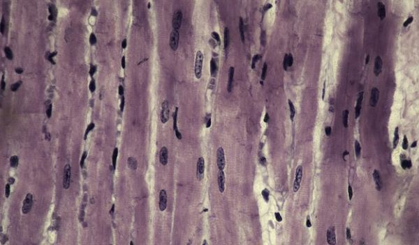 Interdisciplinary teams replicated how mechanical forces reorganize the nuclei of organic tissue.