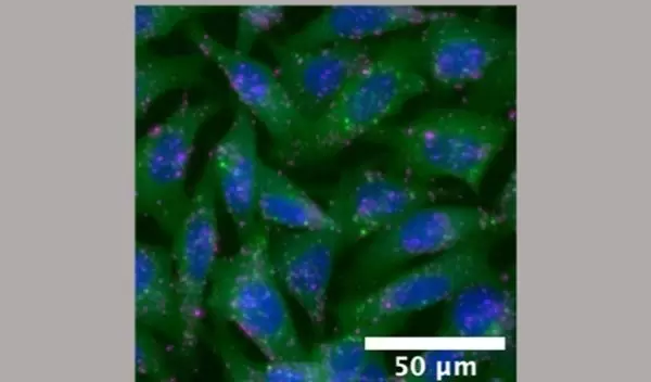 Researchers have developed a screening process for nanoparticle payload delivery.