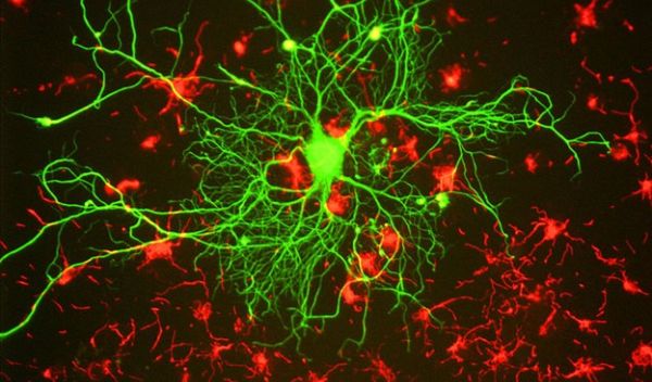 cortical neuron stained with antibody to neurofilament subunit NF-L in green