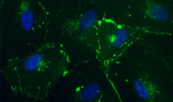 an image of primary human amniotic fluid stem cells in a culture dish