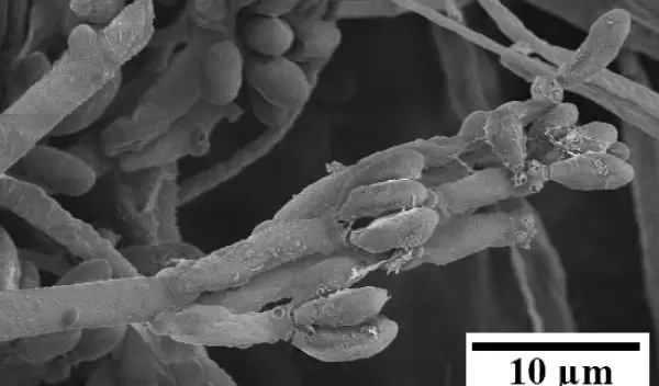A scanning electron micrograph of fungus Nodulisporium sp.
