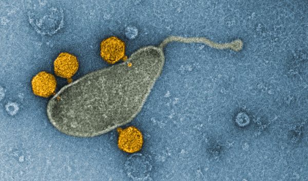 viruses, colored orange, attached to the SAR11 marine bacteria