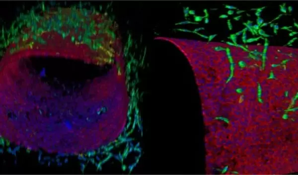 a digital view of a multicellular lymphangion-chip