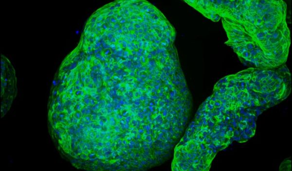 Researchers have developed a synthetic gel that can be used to grow pancreatic organoids, seen here.