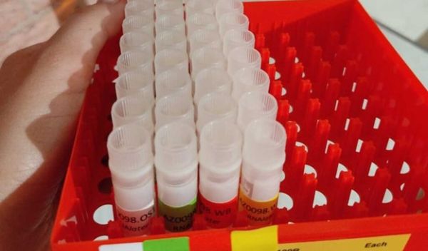 Cryovials containing diagnostic samples collected from bats
