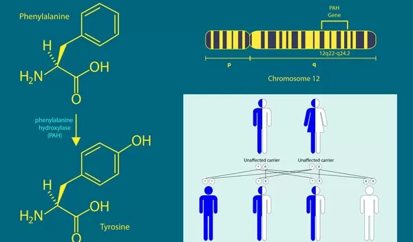 A new discovery offers hope of a treatment for phenylketonuria.