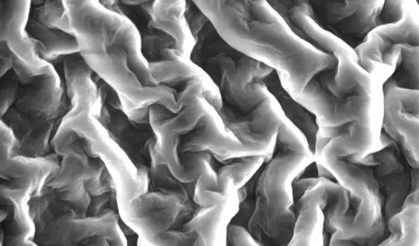 Vesicle membranes that collapse when cooled may someday deliver minute payloads of medicines.