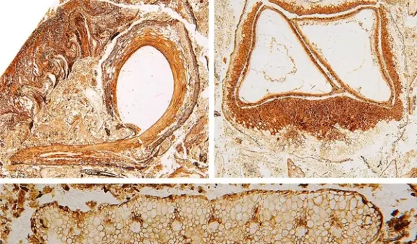 cellulose acetate peels