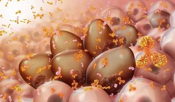 myeloma cells produce monoclonal proteins