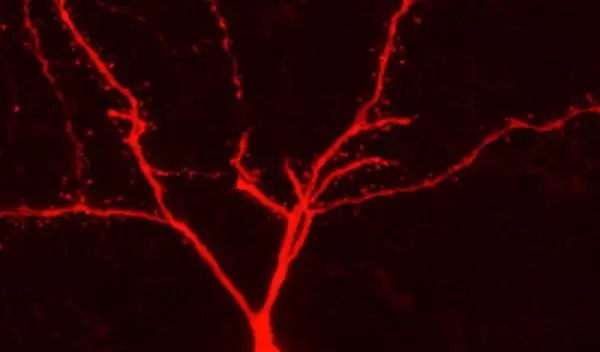 Photo of a rat neuron filled with an agent.
