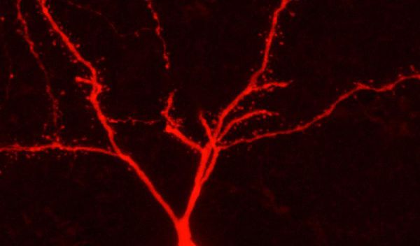 Photo of a rat neuron filled with an agent.