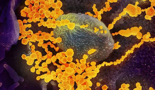 coronavirus disease