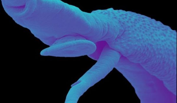 scanning electron micrograph of an adult male and female schistosome worm pair