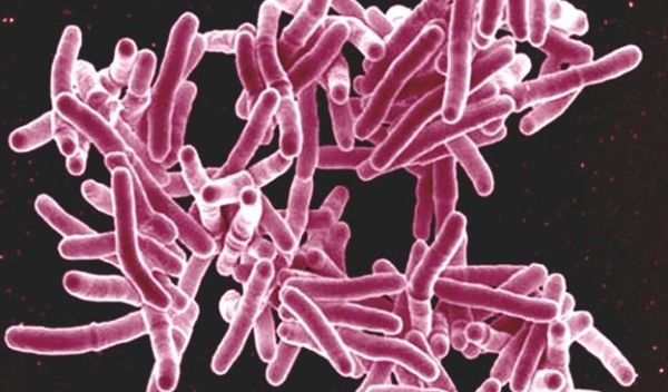 scanning electron micrograph of Mycobacterium tuberculosis bacteria