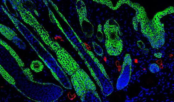 regenerated hair follicles at the center of a wound