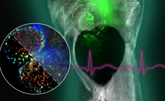 A composite of images related to a new algorithm developed by NSF-funded researchers that will enable better diagnosis of cardiovascular disease.