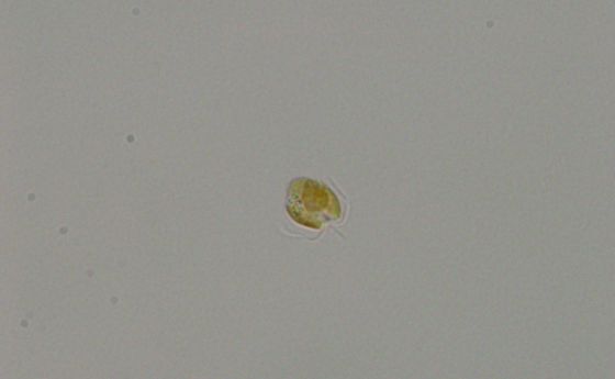 A single golden alga on a slide. The alga has two flagella and a third appendage known as a haptonema.