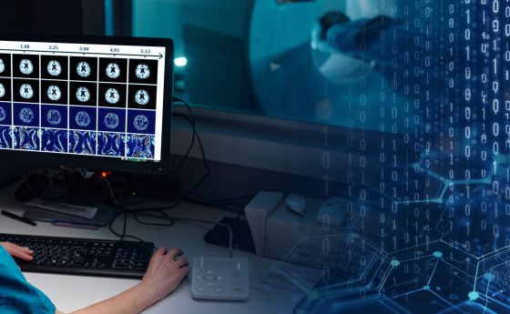 AI and Brain Research