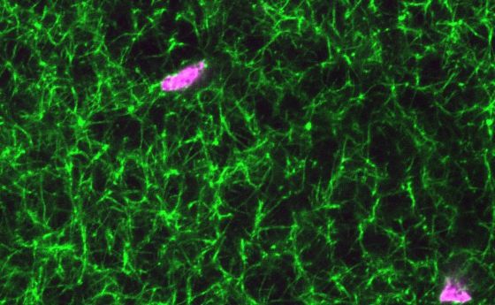 A microscopic image of a blood clot containing synthetic platelet-like-particles. Fibrin is shown in green and the synthetic platelets are pink.
