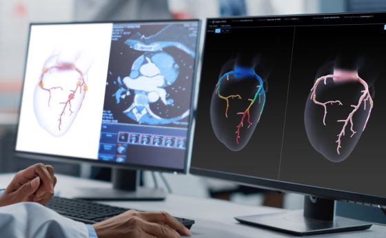 Two computer screens showing images of hearts.