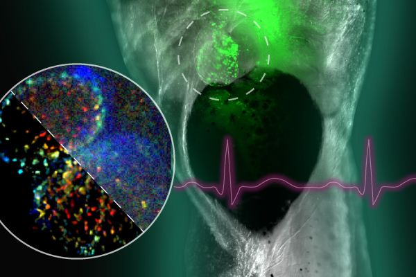 A composite of images related to a new algorithm developed by NSF-funded researchers that will enable better diagnosis of cardiovascular disease.