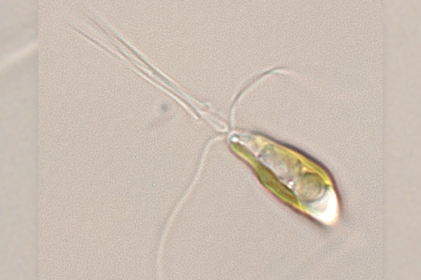 A light microscopy