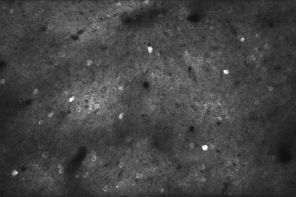 A grayscale image shows several neurons being activated in the mouse auditory cortex during learning of an auditory discrimination task.